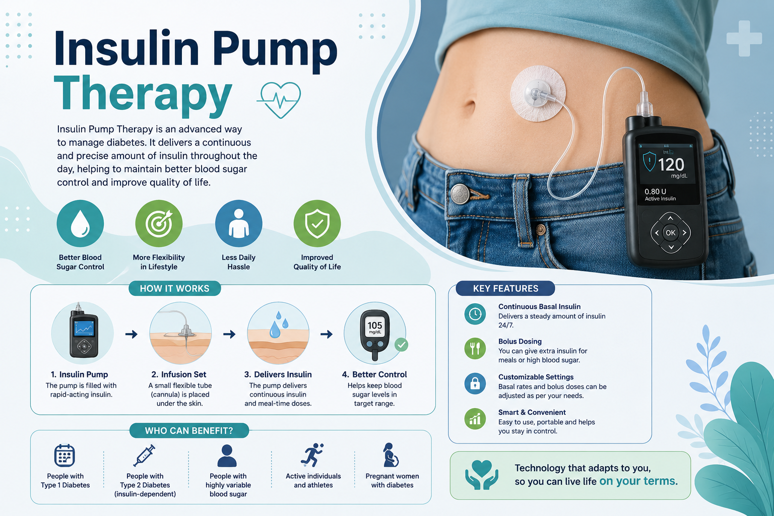 Insulin Pump Therapy