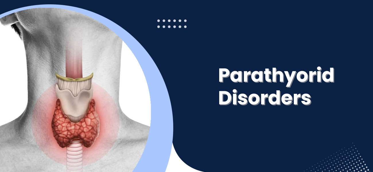 Parathyroid disorders treatment